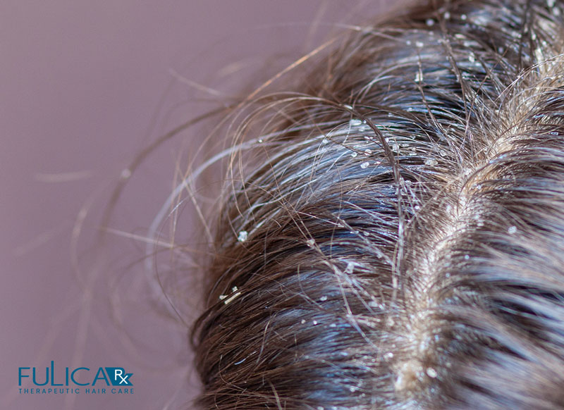 شامپو سولفاسال برای درمان پوسته های ضخیم سر